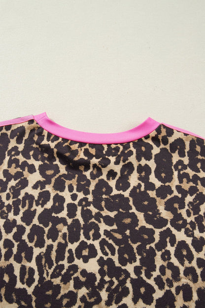 Kaiya Detail Loose T Shirt Dress - Hello Beautiful BoutiqueT Shirt DressesThreaded Pear